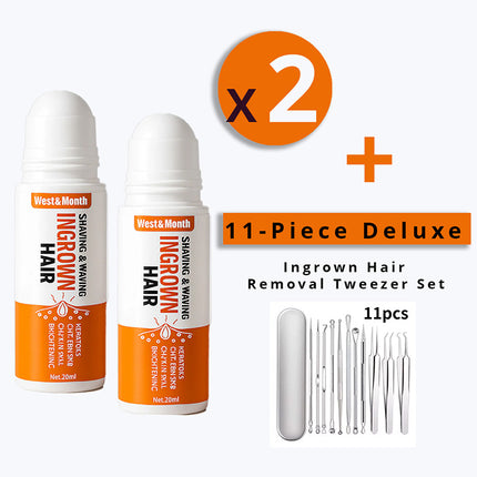 WestandHome’s Ingrown Hair Treatment 2.0