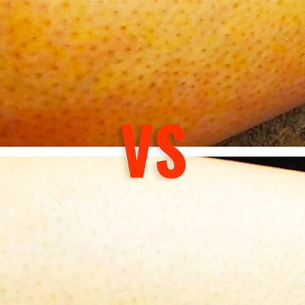 WestandHome’s Ingrown Hair Treatment 2.0