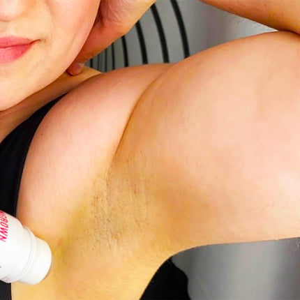 WestandHome’s Ingrown Hair Treatment 2.0